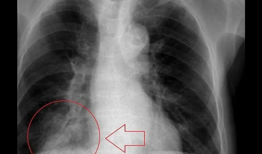 Foto ilustrativa de una radiografía.